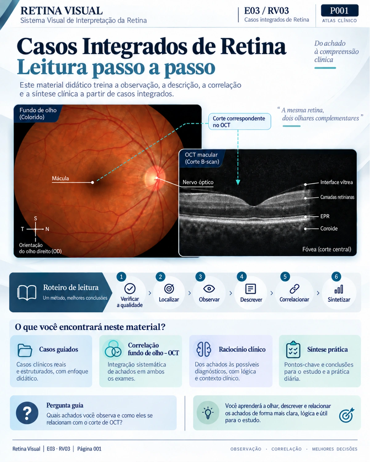 Amostra em português do material de Retina: Casos Integrados · página 1.